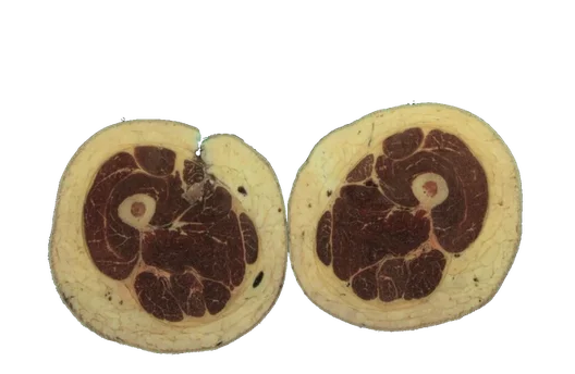 Thigh Anatomy Module from the Visible Human Project (Half Resolution)